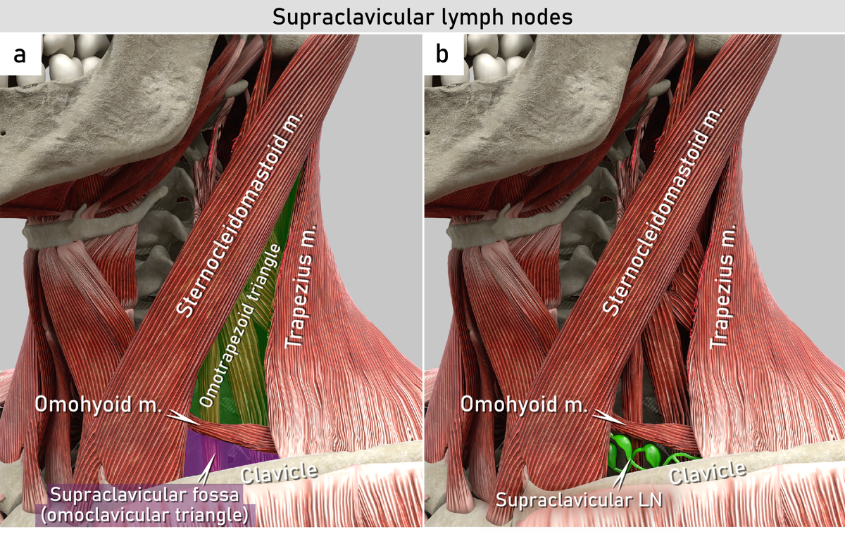 24-5-28   Supraclavicular fossa - Lymphnodes.png